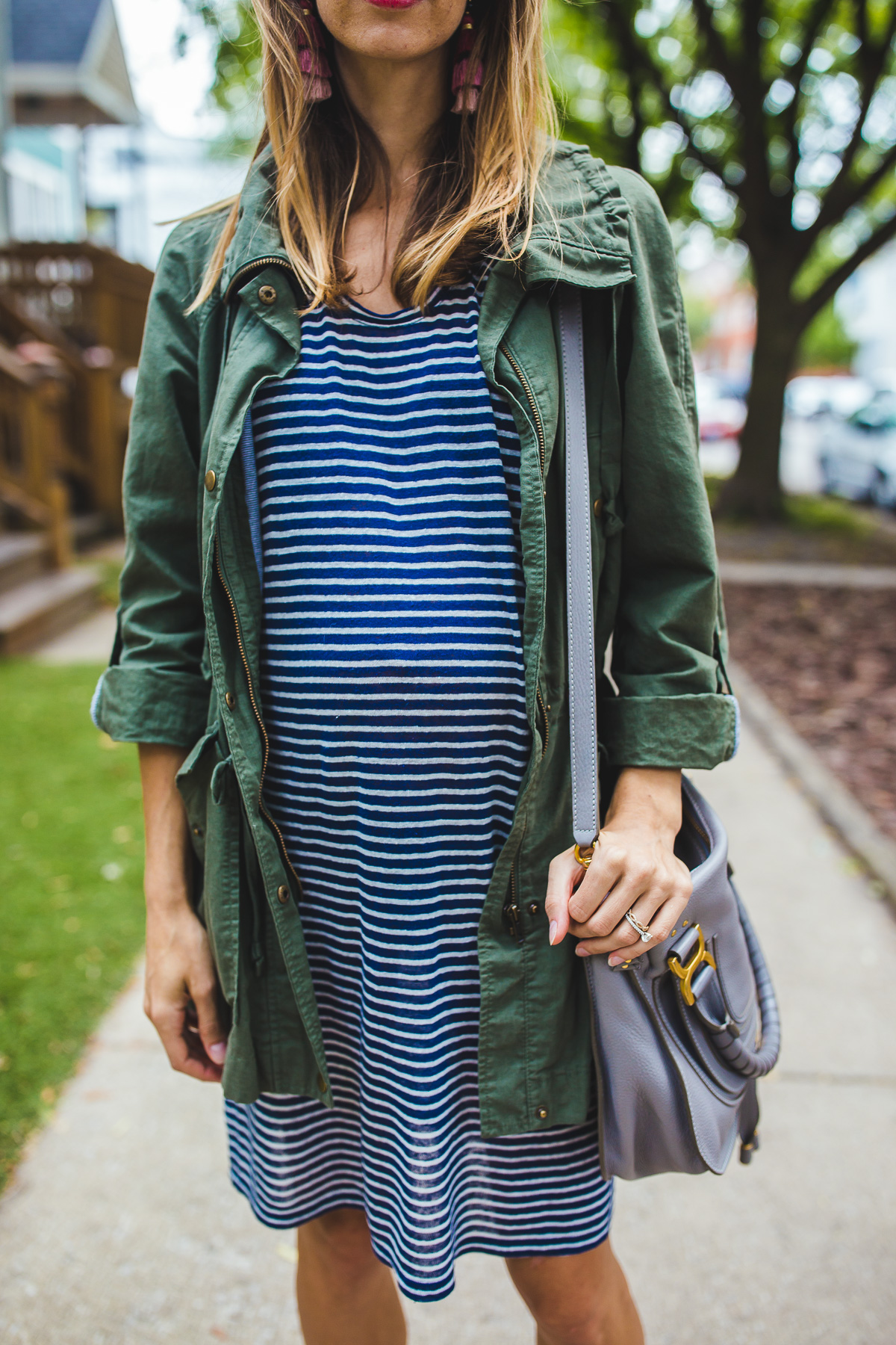 striped dress