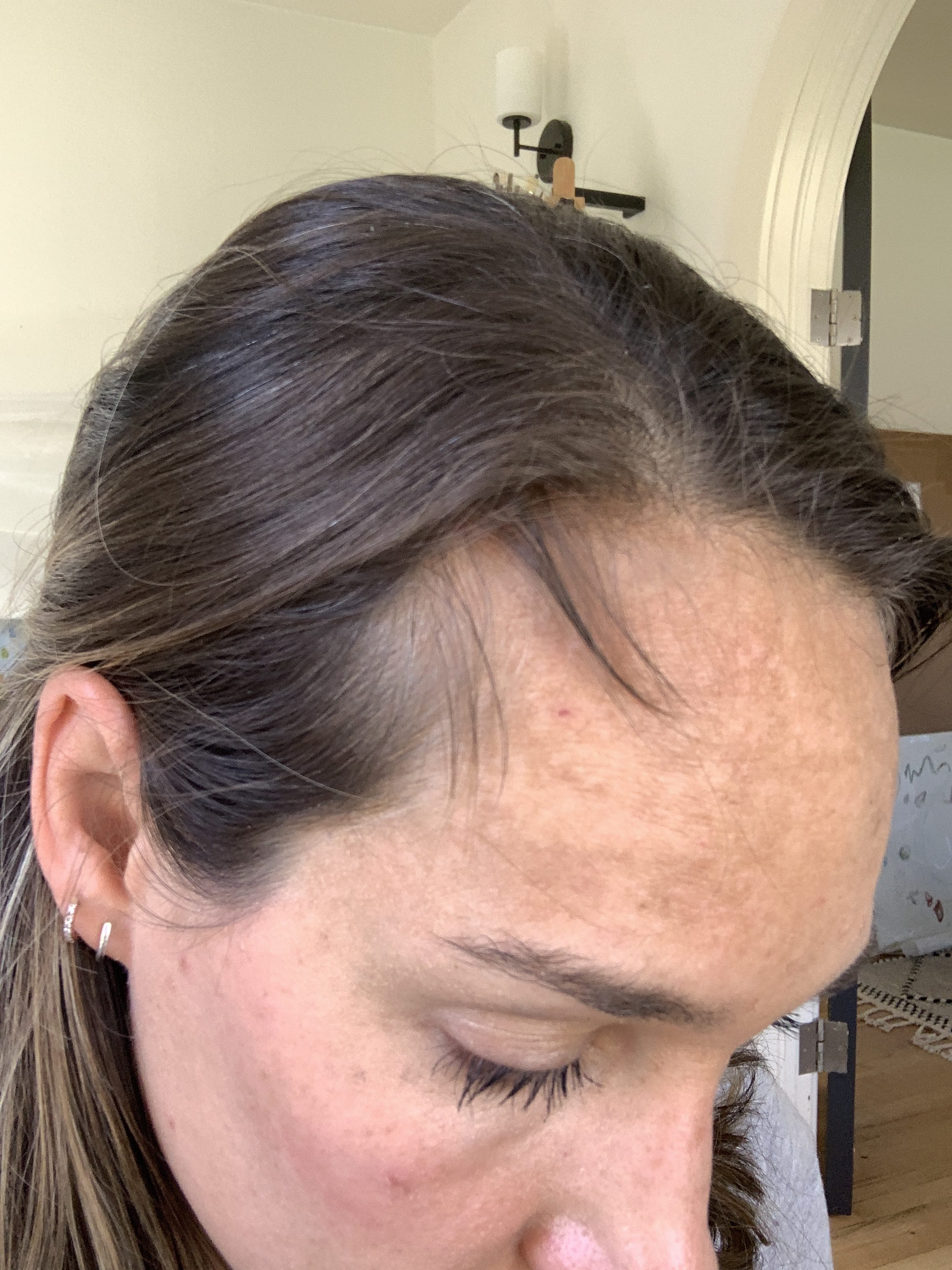 woman's hair before taking liquid collagen
